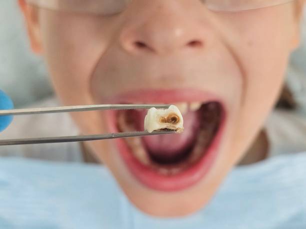 Best Emergency Pediatric Dentist  in Annapolis Neck, MD